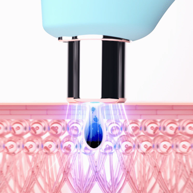 Removedor de cravos FOREO KIWI™ com luz LED azul