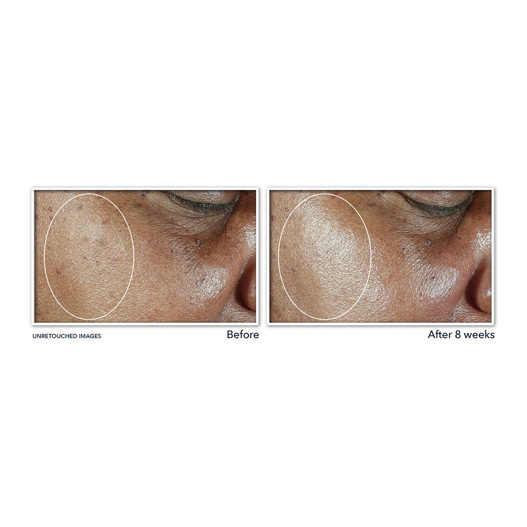 RoC Hydratant quotidien SPF 30