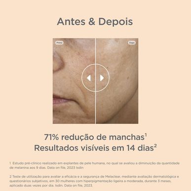 Isdinceutics Brighten Melaclear Anti-Dark Spot Serum Kasvoseerumi tummien läiskien ja hyperpigmentaation vähentämiseen 30 ml 30 ml
