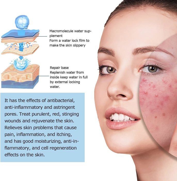 Système de micro-infusion pour le visage lèvres, Acide hyaluronique, Microdart Roller à micro-infusion, système facial avec sérum