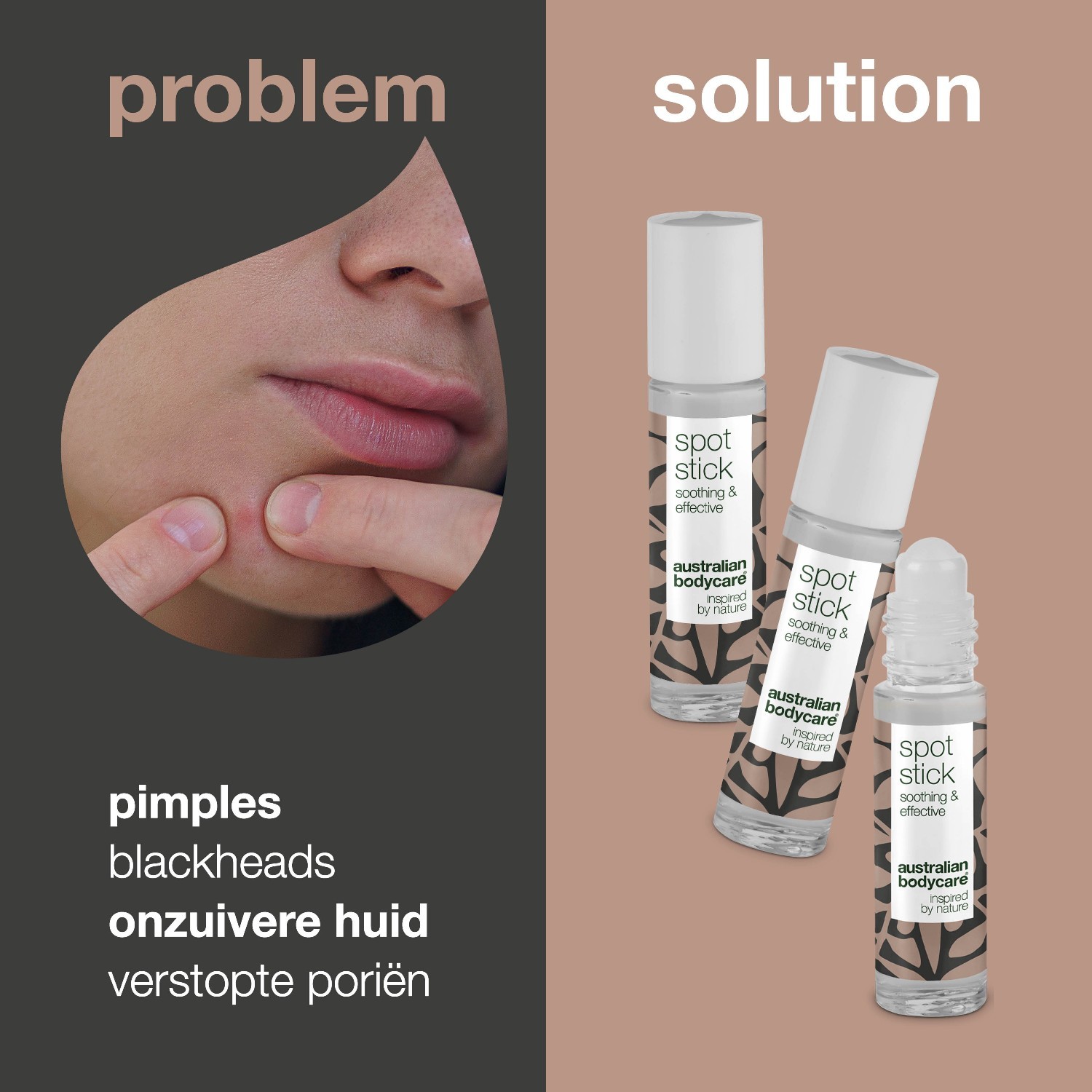 Australian Bodycare set za njegu lica 3x9ml stik za mrlje - 1 komad