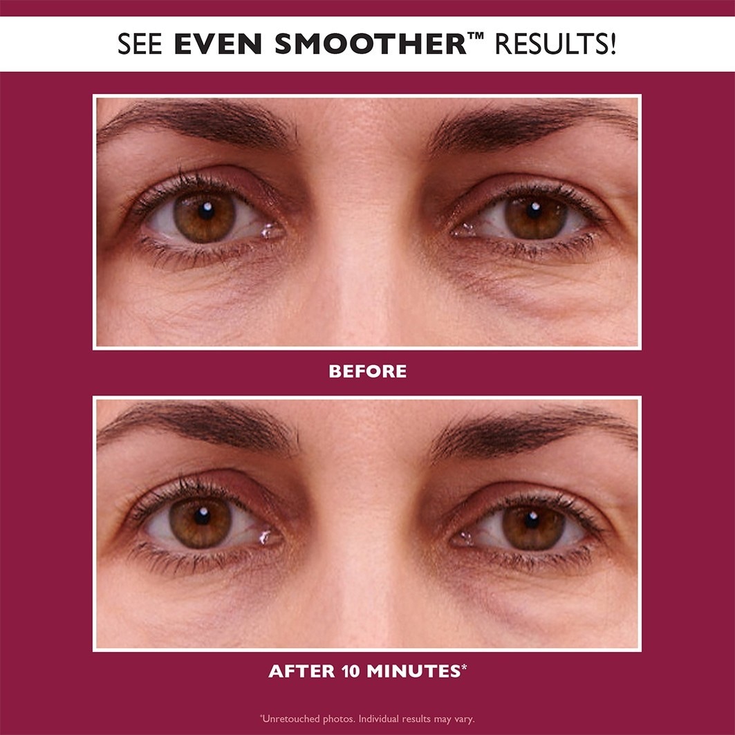 Peter Thomas Roth Eye Pad Even Smoother™ Glycolic Retinol Hydra-Gel – 1 unidade