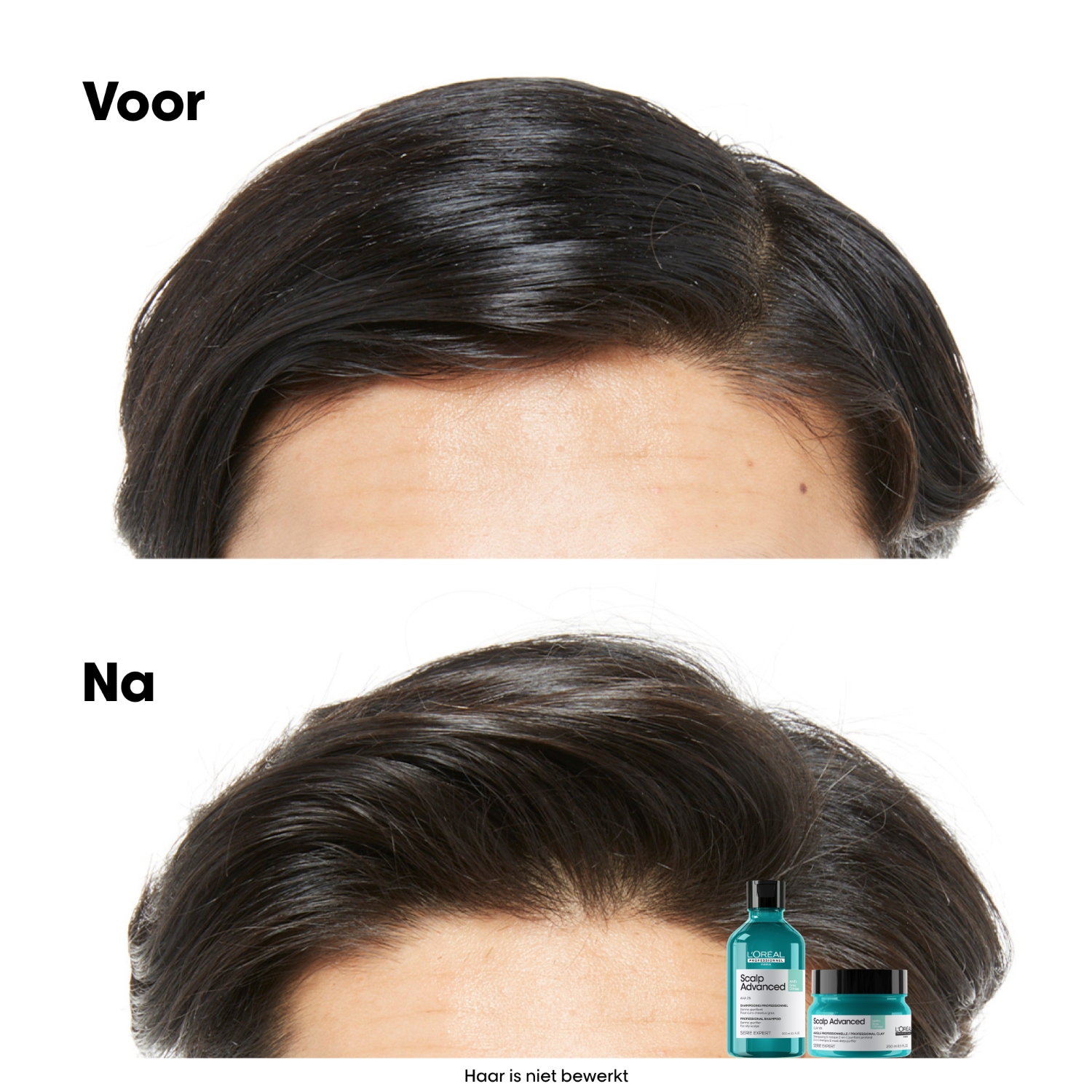 L'Oréal Professionnel Hair Shampoo Scalp Advanced Dermolimpiador Anti-Filinesidad - 300ml