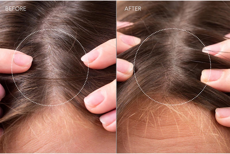 FOREO FAQ™ Scalp Recovery & Thick Hair Probiotic Serum пробиотички серум за регенерацију косе и коже главе