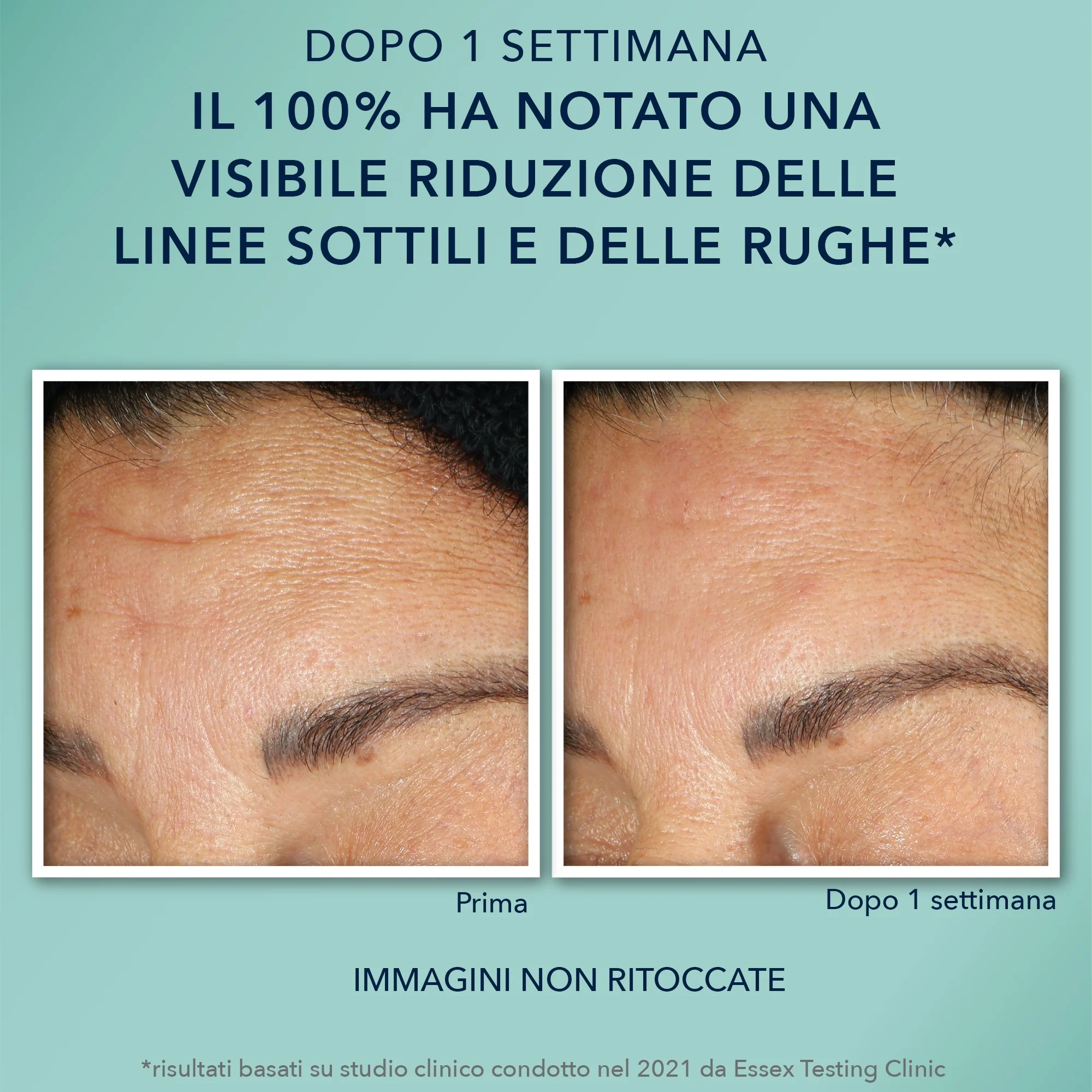 Multi Correxion Hydrate + Plump Siero Viso in Capsule - Siero viso idratante, Siero viso antirughe, Siero viso effetto globale