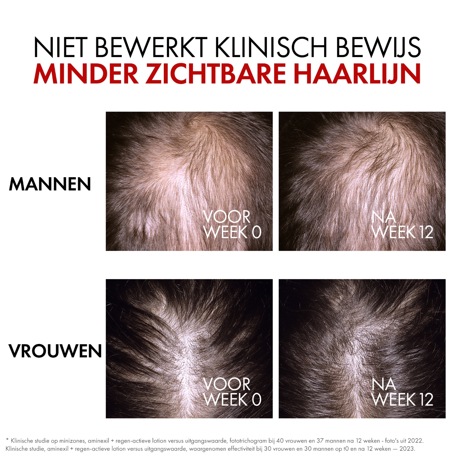Vichy haarserum Dercos Aminexil Clinical REGEN Booster - 90 ml