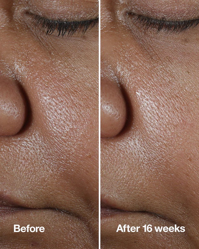 Sérum Corretor de Rugas Clinique Smart Clinical™ Repair