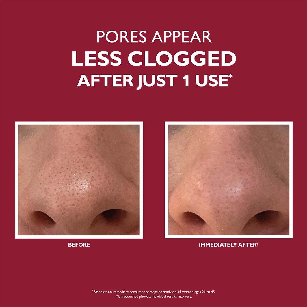 Peter Thomas Roth Pleťový peeling Even Smoother™ Mikrodermabrázia Exfoliačný zjemňujúci póry - 50 ml