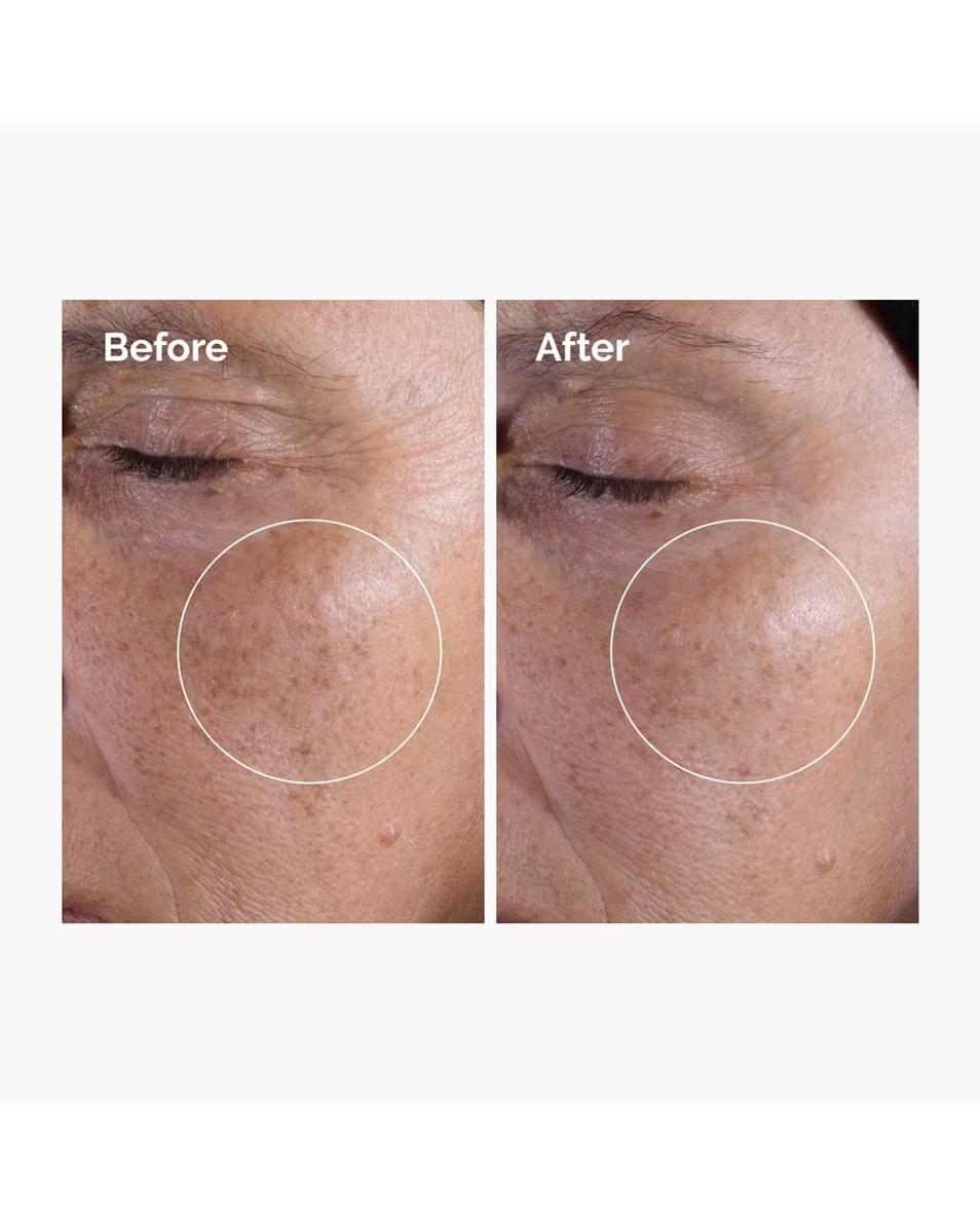 THE ORDINARY Toner Απολεπιστική Λοσιόν με Γλυκολικό Οξύ 7%
