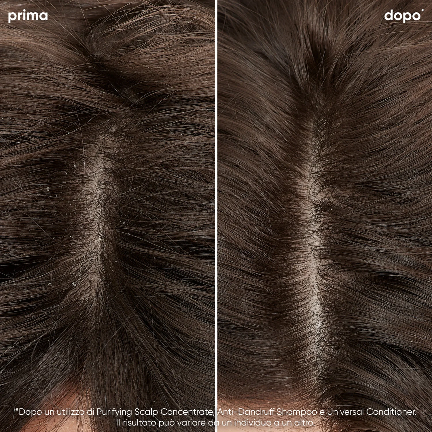 Scalp Sync Anti-Dandruff Shampoo - Shampoo Antiforfora
