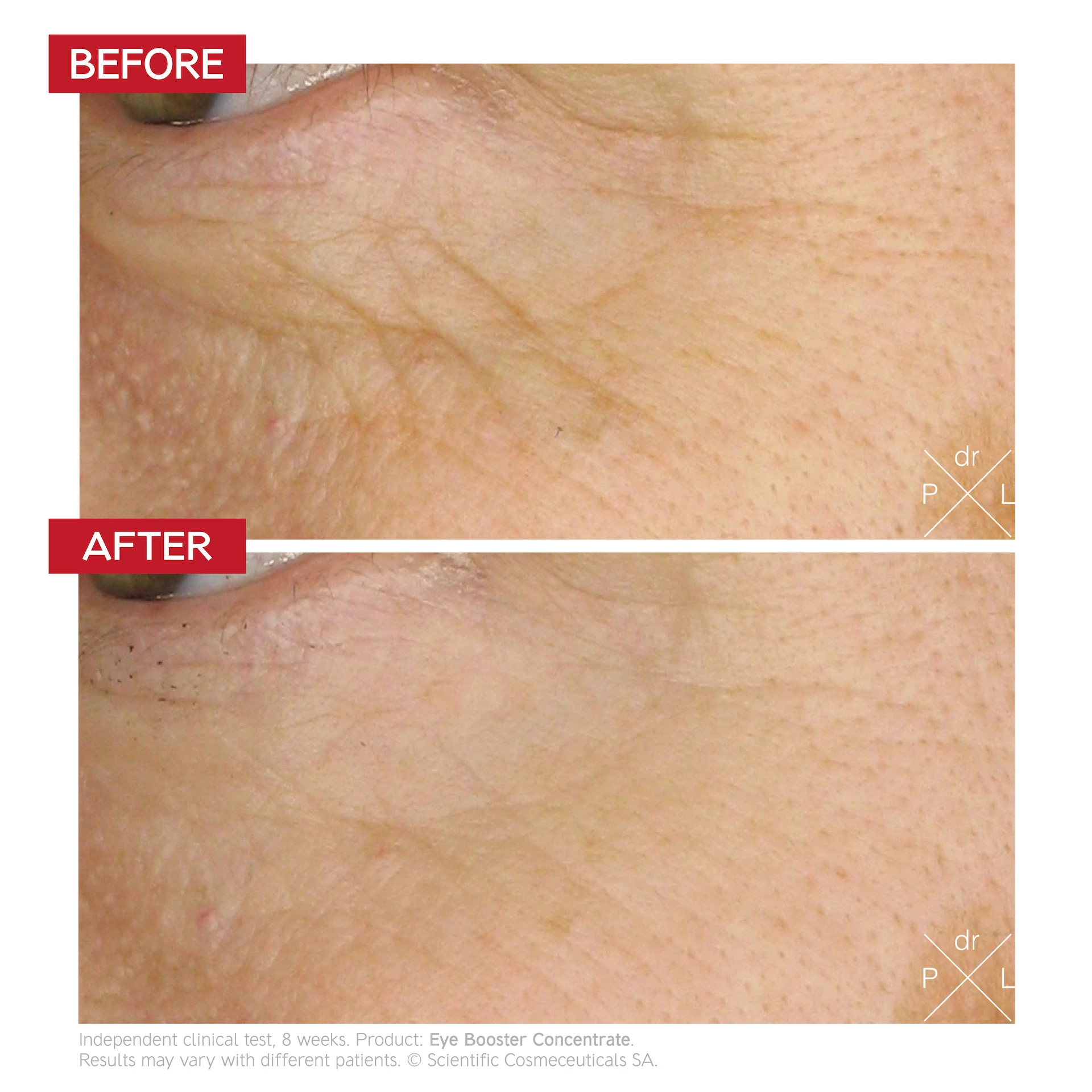 Dr. LEVY Szemkörnyékápoló Koncentrátum Luxe Travel 7 ml - Dr. LEVY Svájc