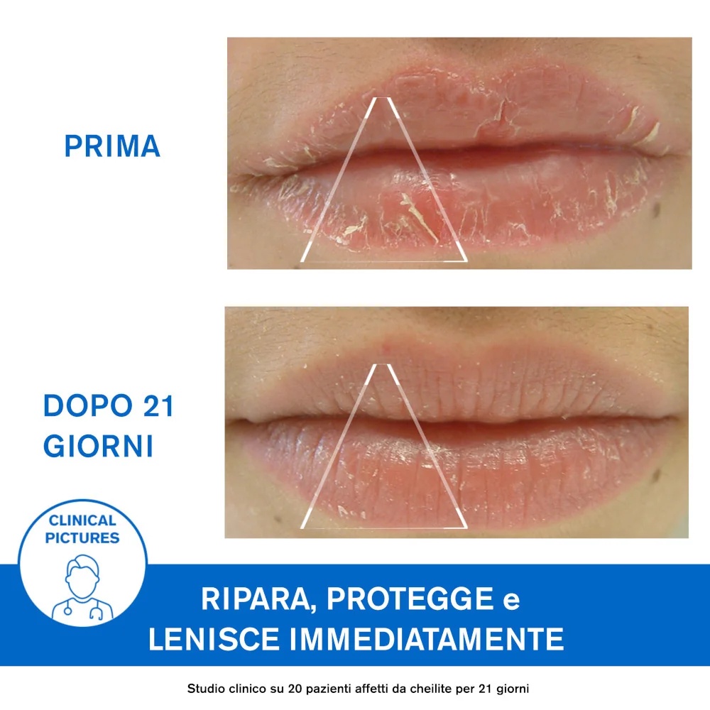 URIAGE Uriage Barièderm Cica-Levres lippenbalsem voor droge en schrale lippen 15 ml barrièrebalsem