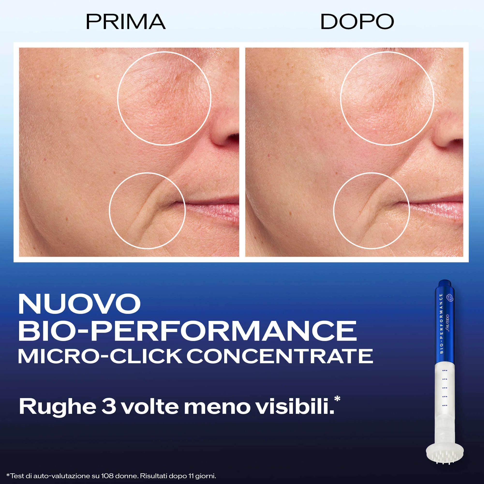 Bio-Performance Micro-Click Concentrate - Filler lifting