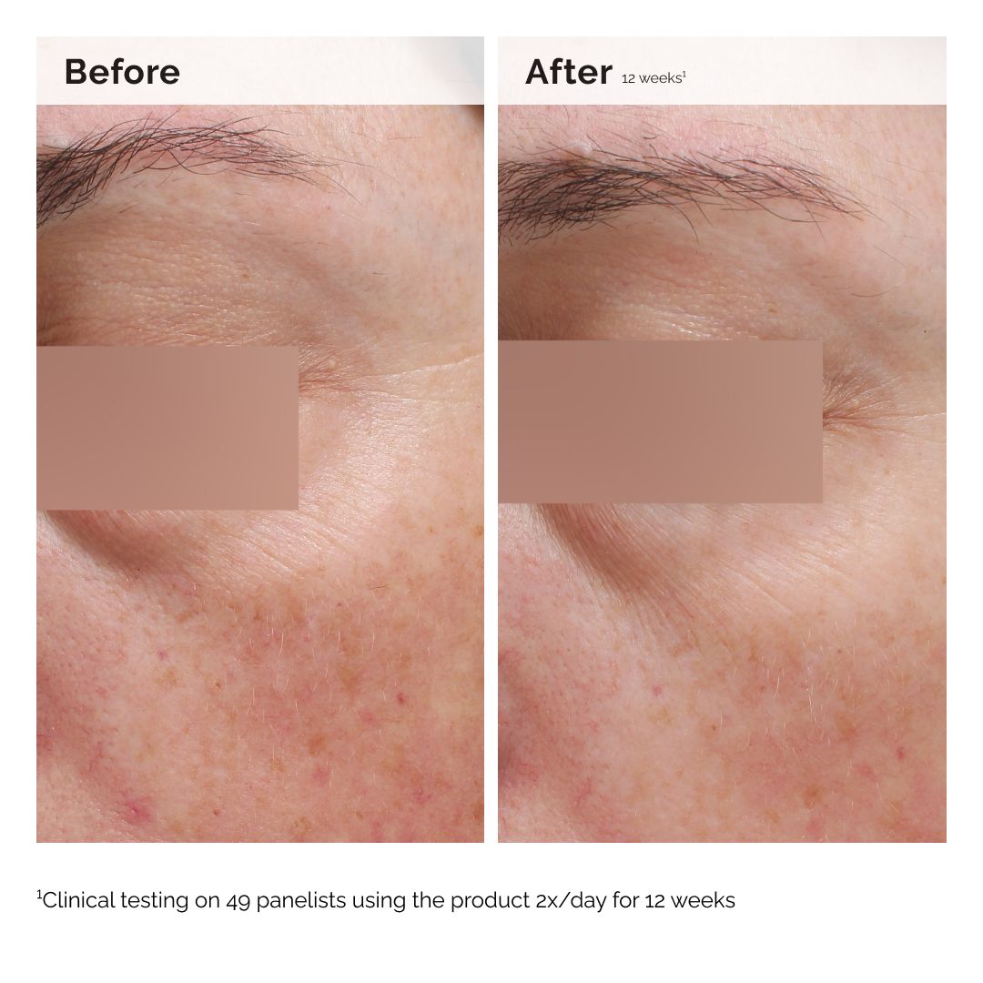 Niacinamide 5% emulzija za lice i tijelo Cosmética corporal