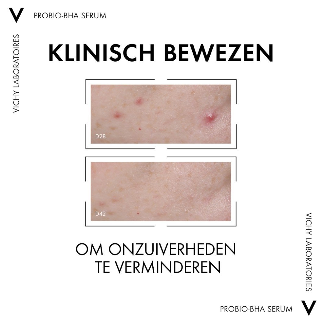Vichy Anti-Blemish Care Normaderm Probio-BHA serum za mrlje - 30 ml