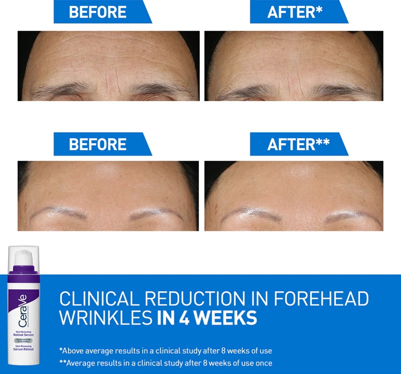 CeraVe Skin Renewing Retinol Serum pretgrumbu serums ar retinolu, kas atjauno ādas aizsargbarjeru