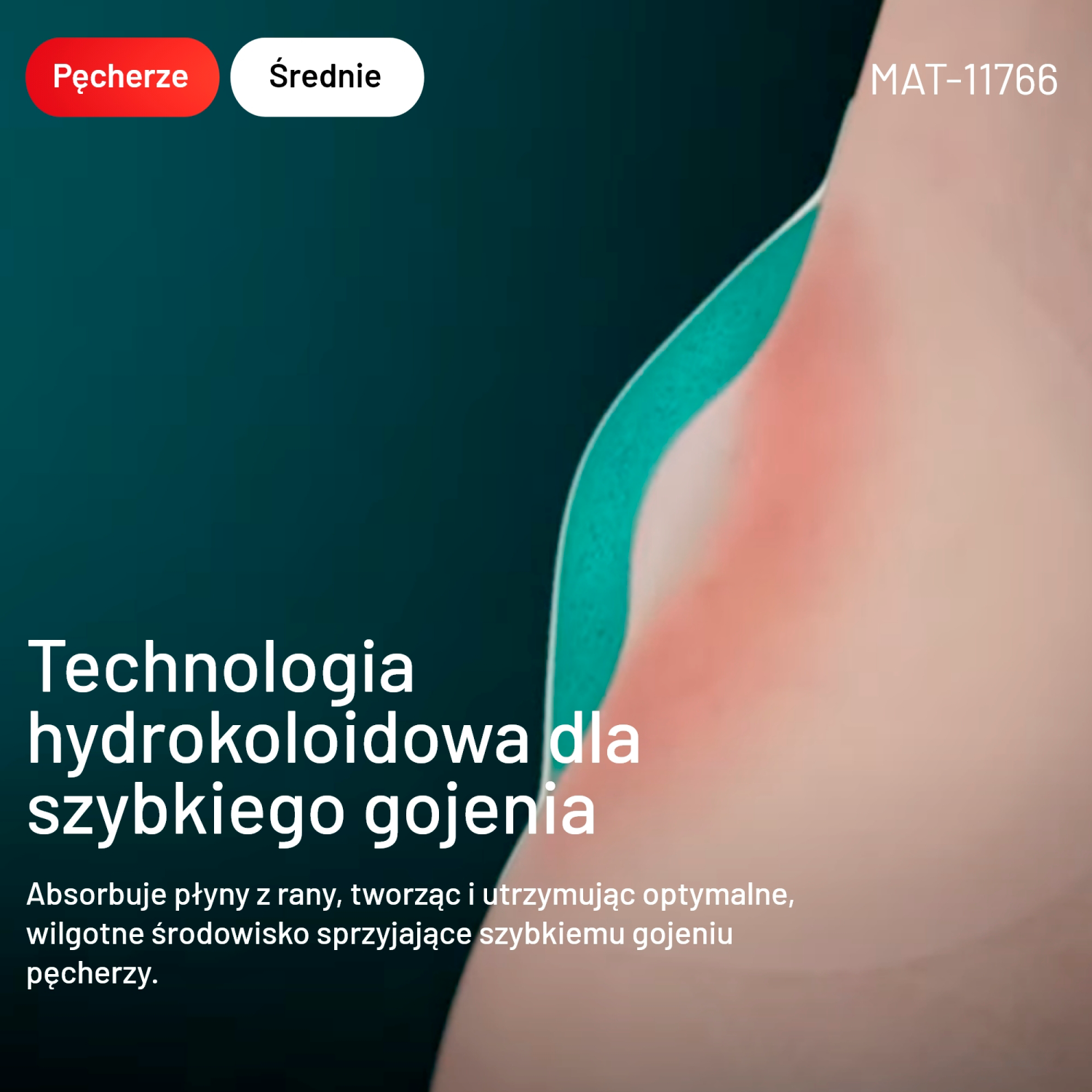 Compeed