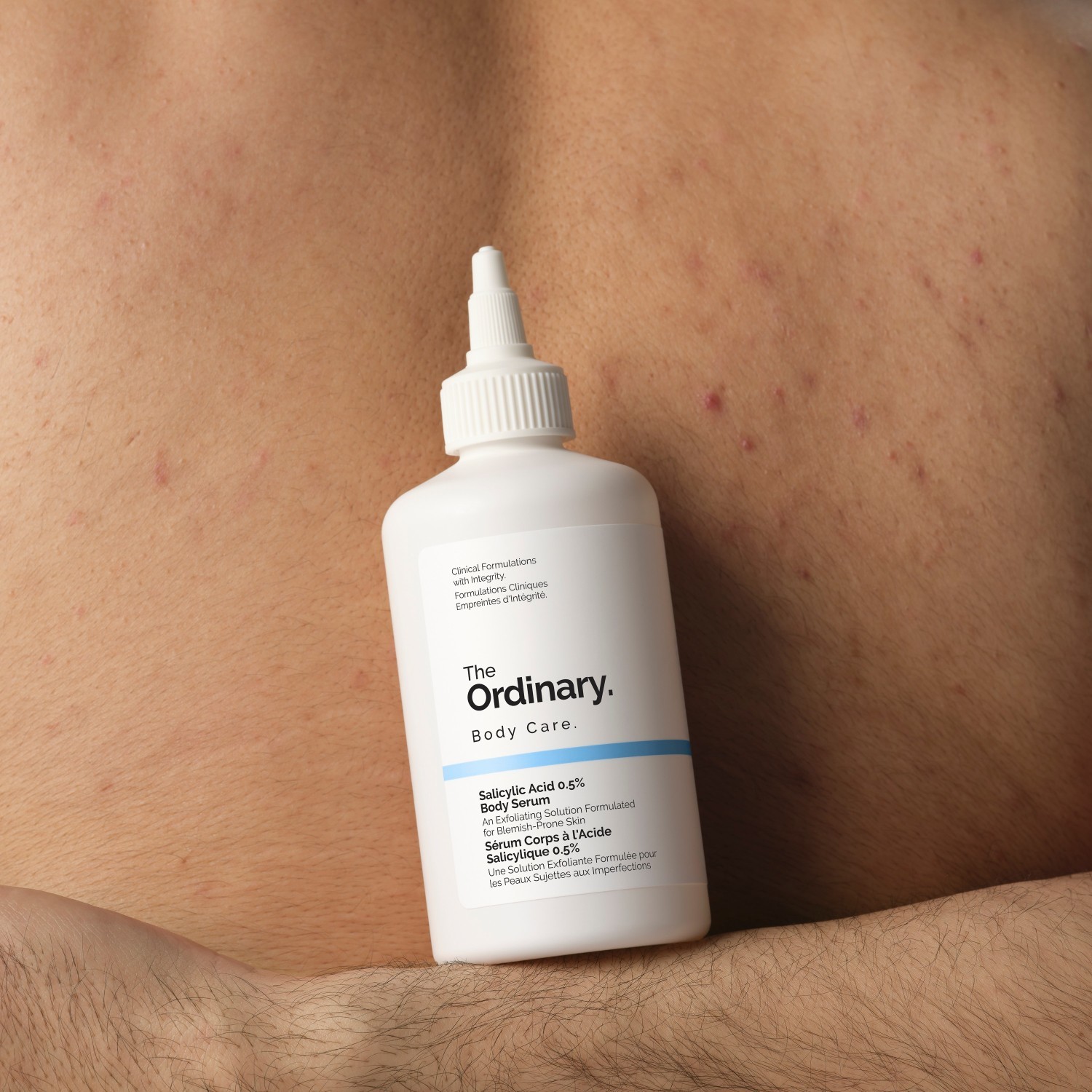Obyčajný telový peeling pre jednotnú pleť. 0,5% kyselina salicylová – 240 ml