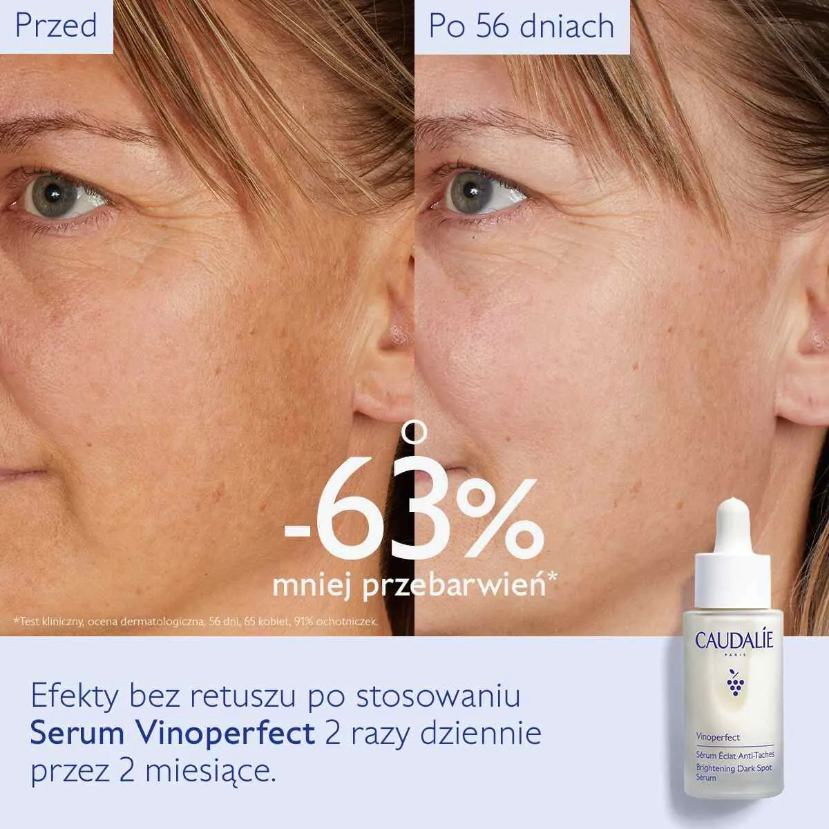 Caudalie Vinoperfect Serum rozjaśniające przebarwienia