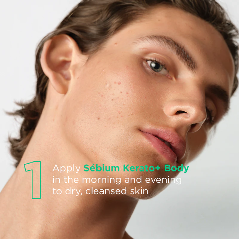 Spray corporal Bioderma Sébium Kerato+ para acne, vermelhidão e cicatrizes de acne.