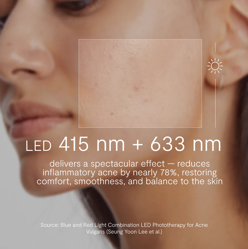 GLOV Supernova Adesivo de Tratamento Localizado para Acne com Máscara de LED para Cicatrização