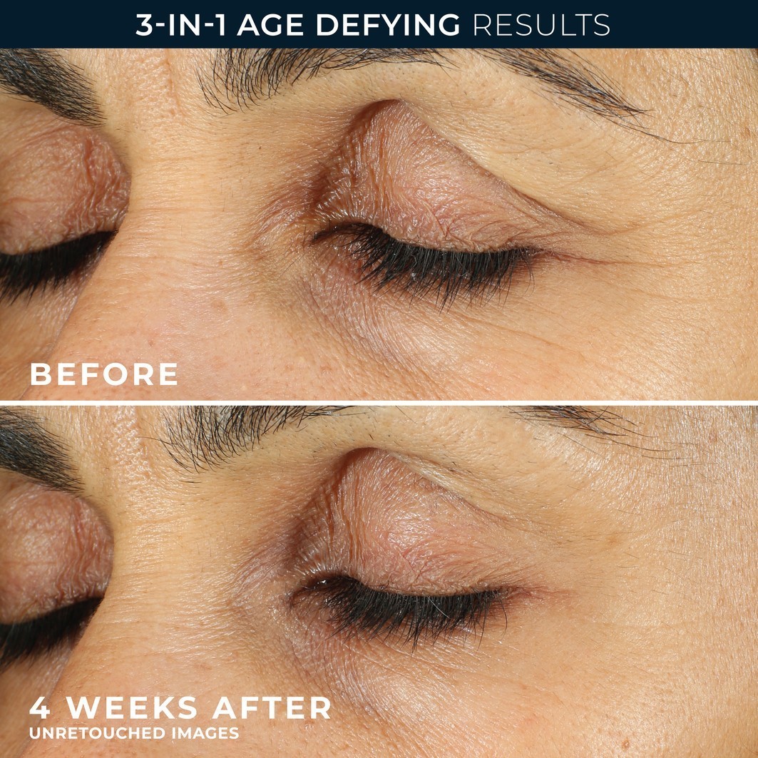 RoC krema za oči Retinol Correxion Fine Line Retinol Correxion za zaglađivanje linija - 15 ml