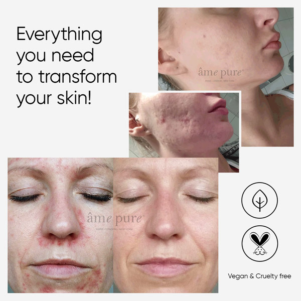âme pure CIT Face Roller PLATINA 0,5 mm