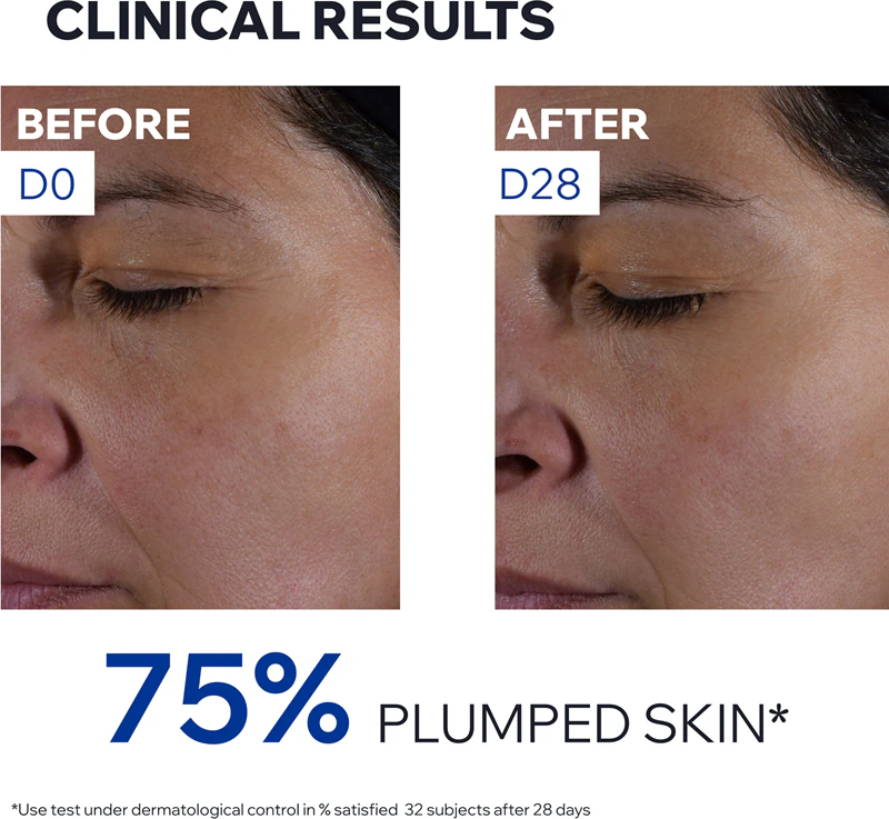 Uriage Age Absolu Redensifying Rosy Cream is een anti-rimpelcrème met een verhelderend effect, liftend effect en hyaluronzuur.