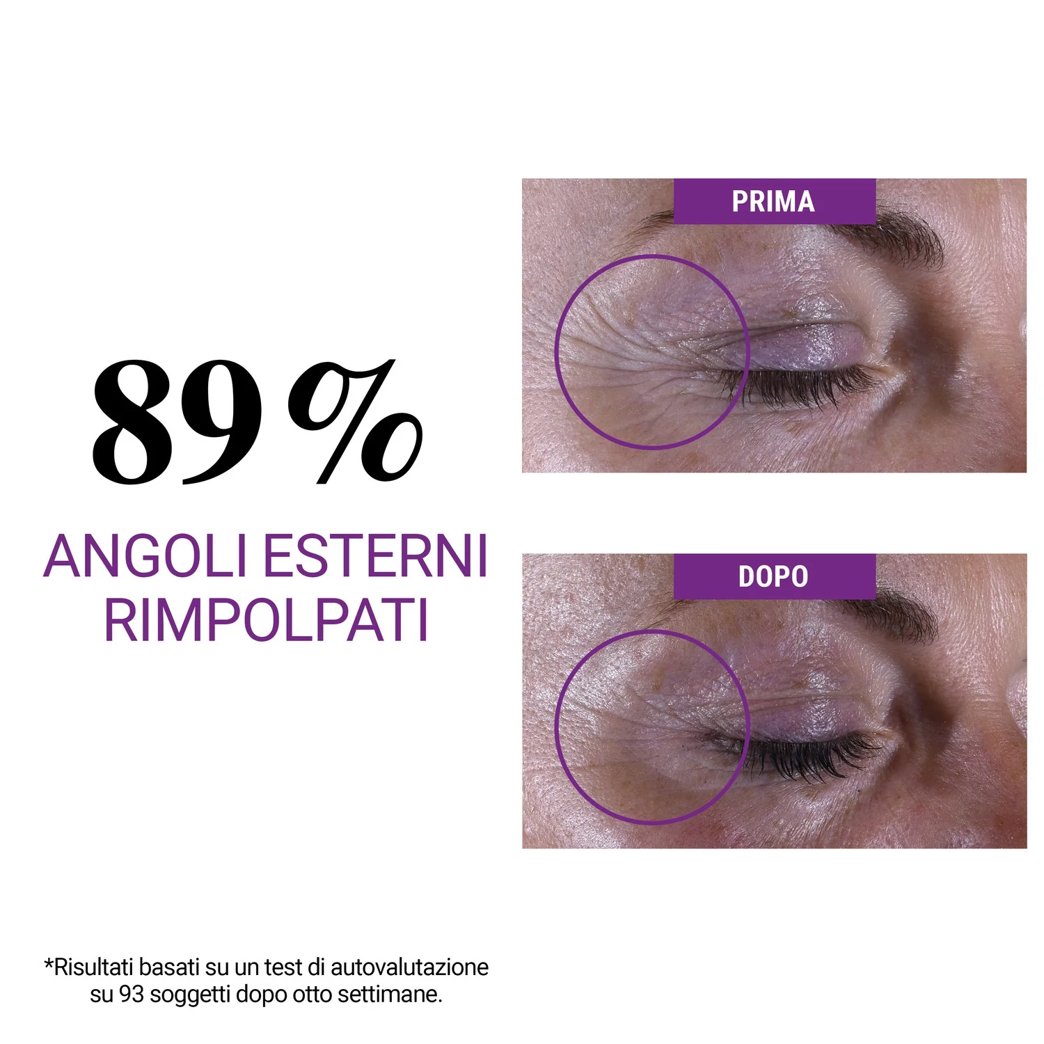 Labbra e Occhi Super Multi-Corrective Eye Zone Treatment - Contorno occhi antirughe