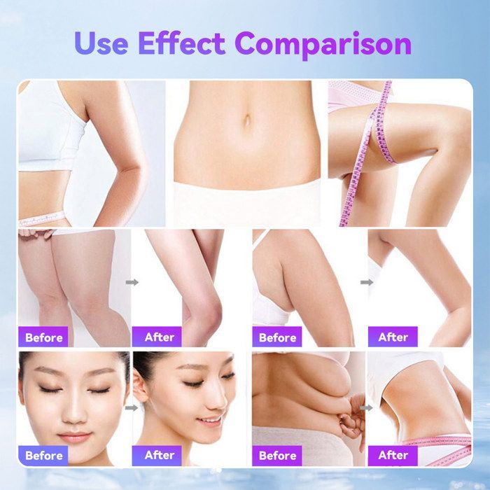4-in-1 schoonheidsapparaat – 5 MHz radiofrequentie, 40 kHz ultrageluid, EMS, zuignap – anti-aging, lichaamsvorming
