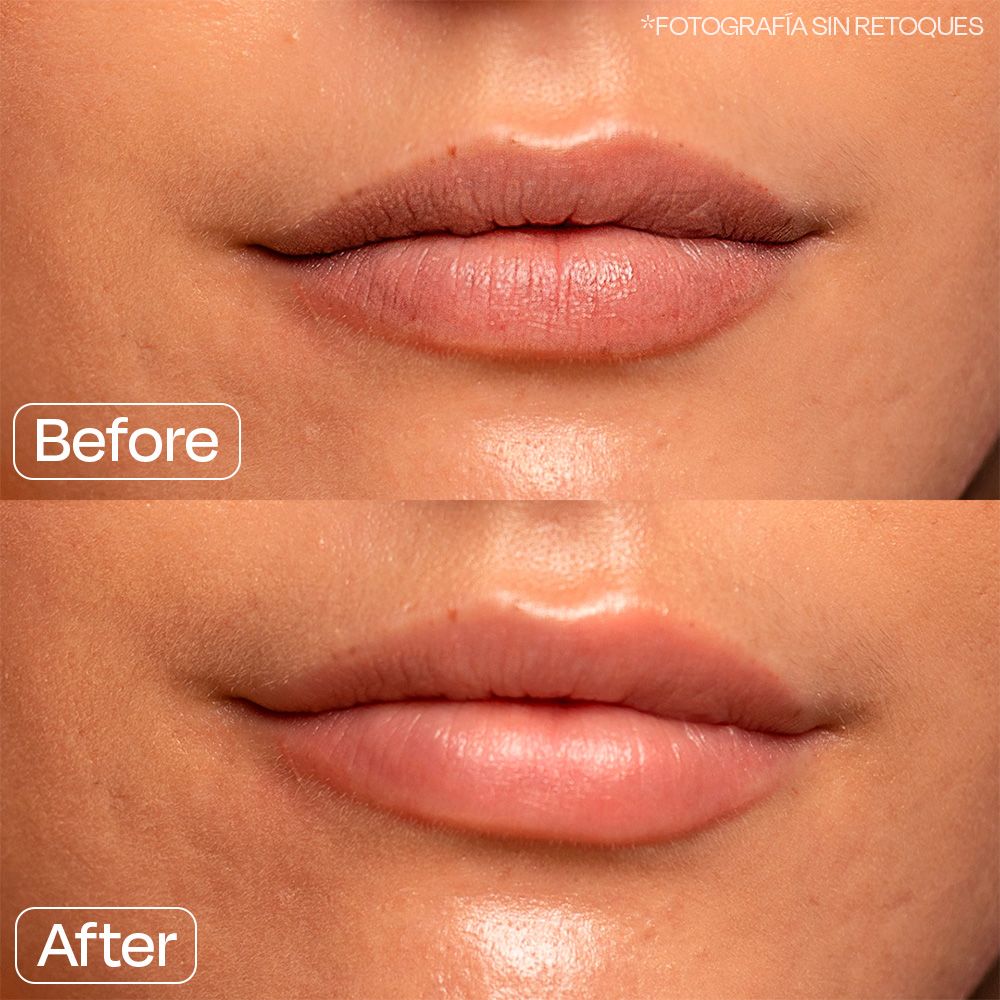 Maska za ustnice Oh My Lips Ustnice: balzami in nega