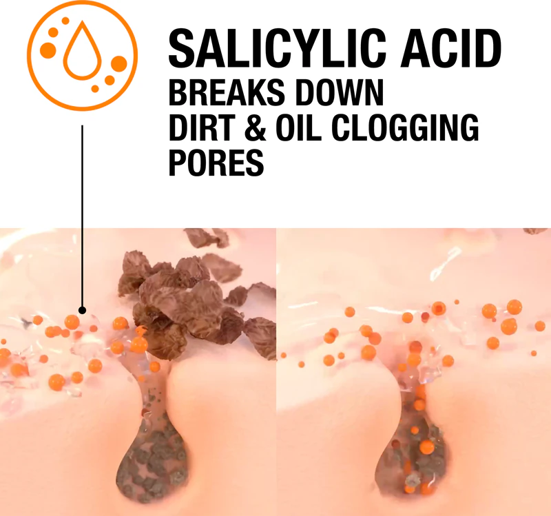 Peeling de ácido salicílico Neutrogena Clear & Defend