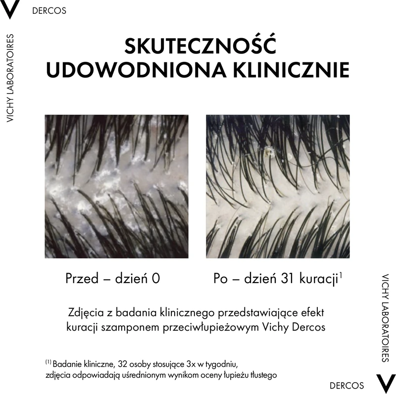 Shampoo Anticaspa Vichy Dercos para Cabelos Normais a Oleosos