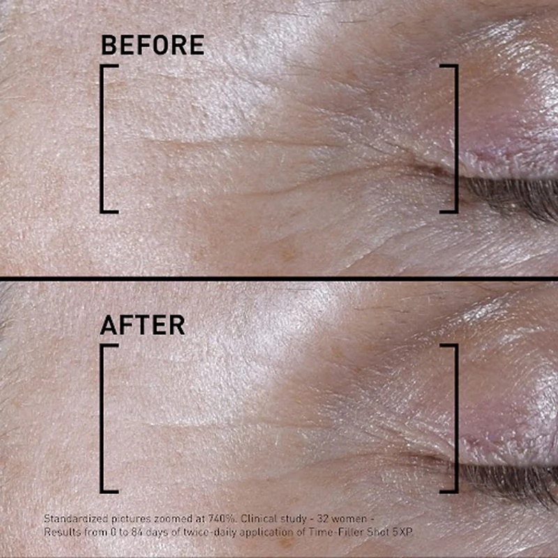 FILORGA TIME-FILLER SHOT intenzivni serum proti prvim znakom staranja kože