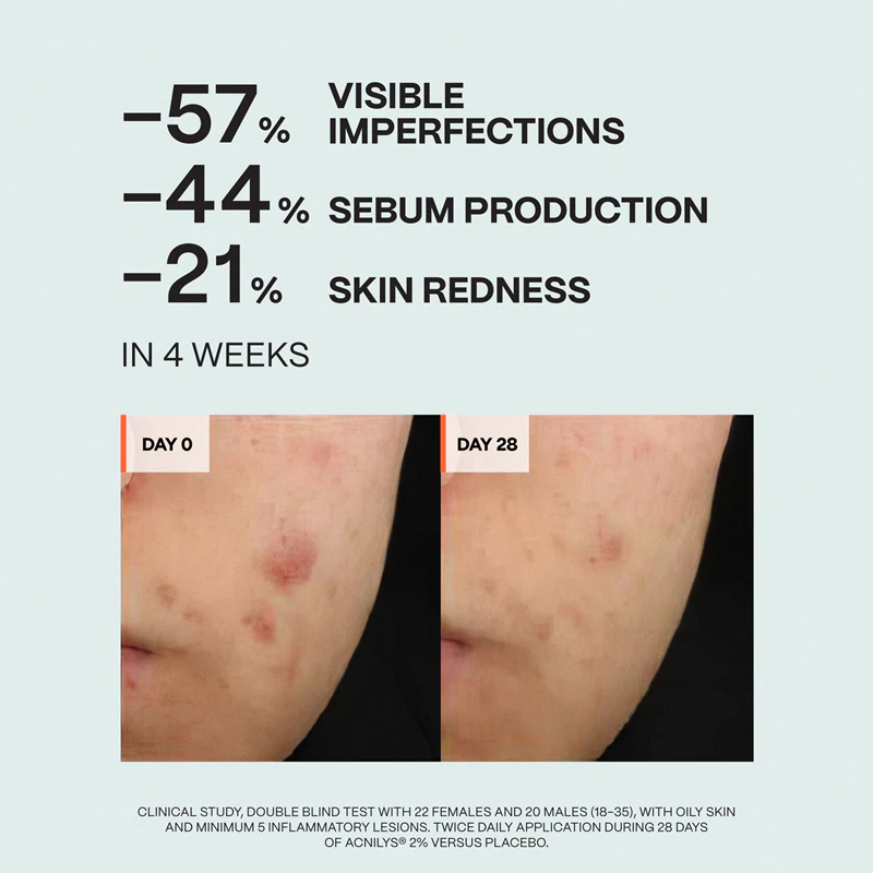 Saffee ClearDerm denní a noční sada péče pro problematickou pleť