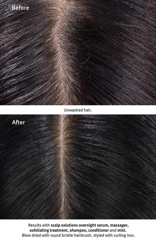 Aveda Scalp Solutions Exfoliating Scalp Treatment exfoliačný gél na regeneráciu pokožky hlavy