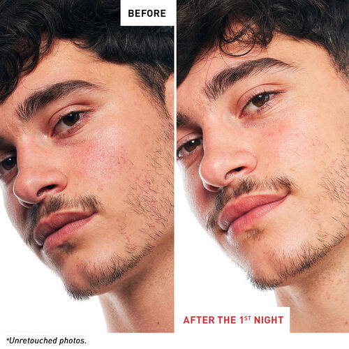 Huile-sérum de nuit multi-perfectionnante Skin Therapy
