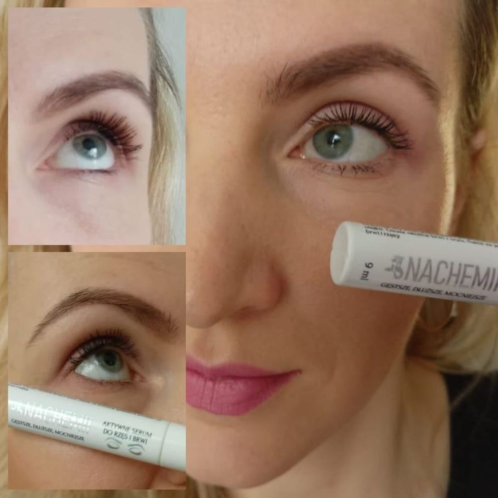 Nachemii serum za trepalnice