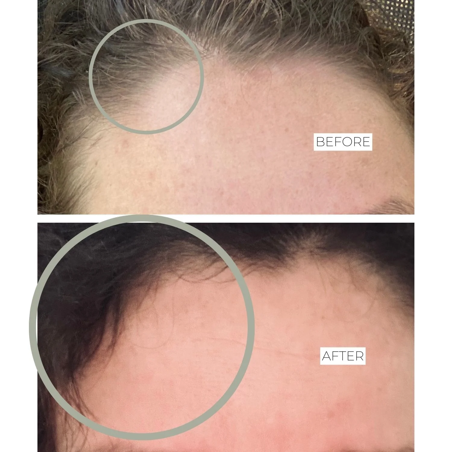 Integratori Stop & Grow Hair - Integratore Unghie e Capelli