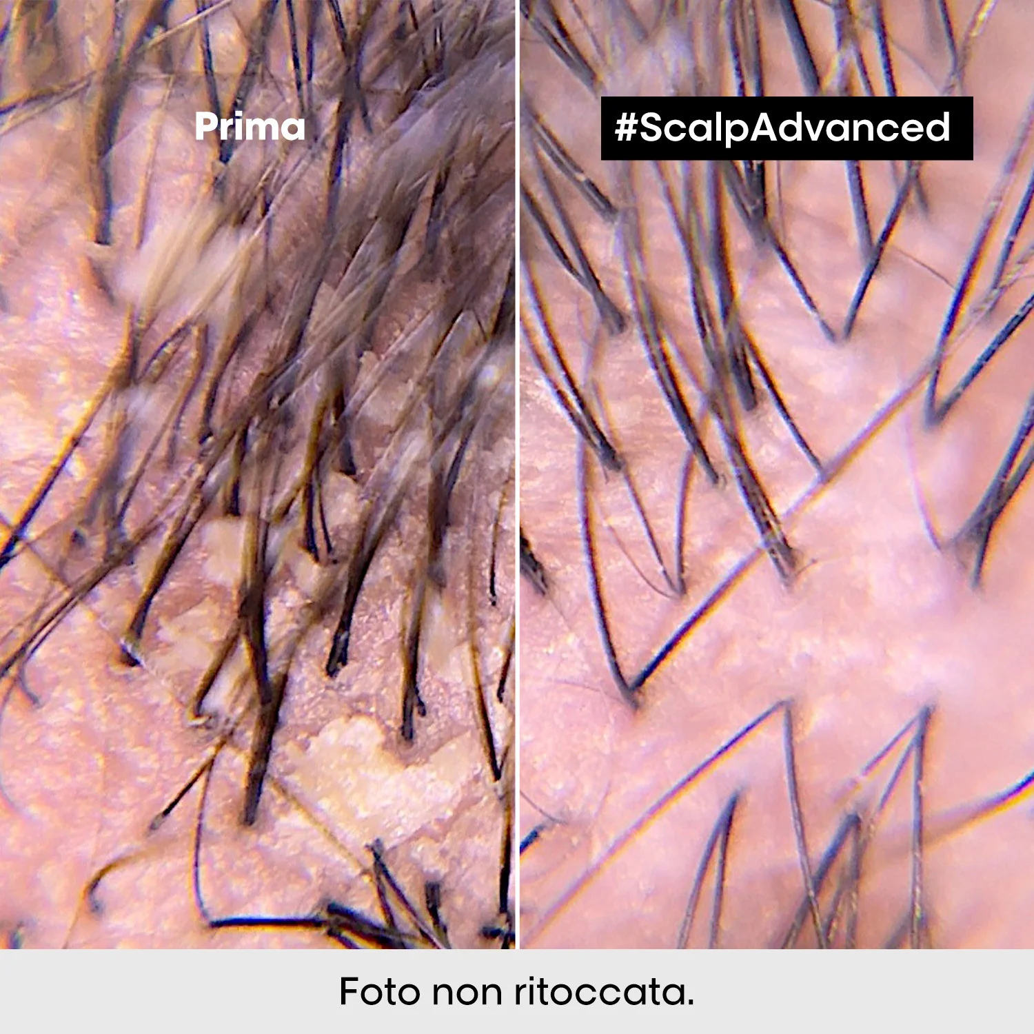 SERIE EXPERT New Scalp Advanced Shampoo Anti-Dandruff - Shampoo Antiforfora