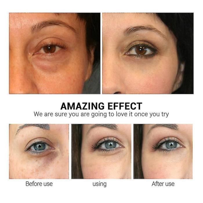 Hidratante facial, pegatinas invisibles para levantar los ojos, eliminar arrugas, bolsas y ojeras, antienvejecimiento [B899232596]