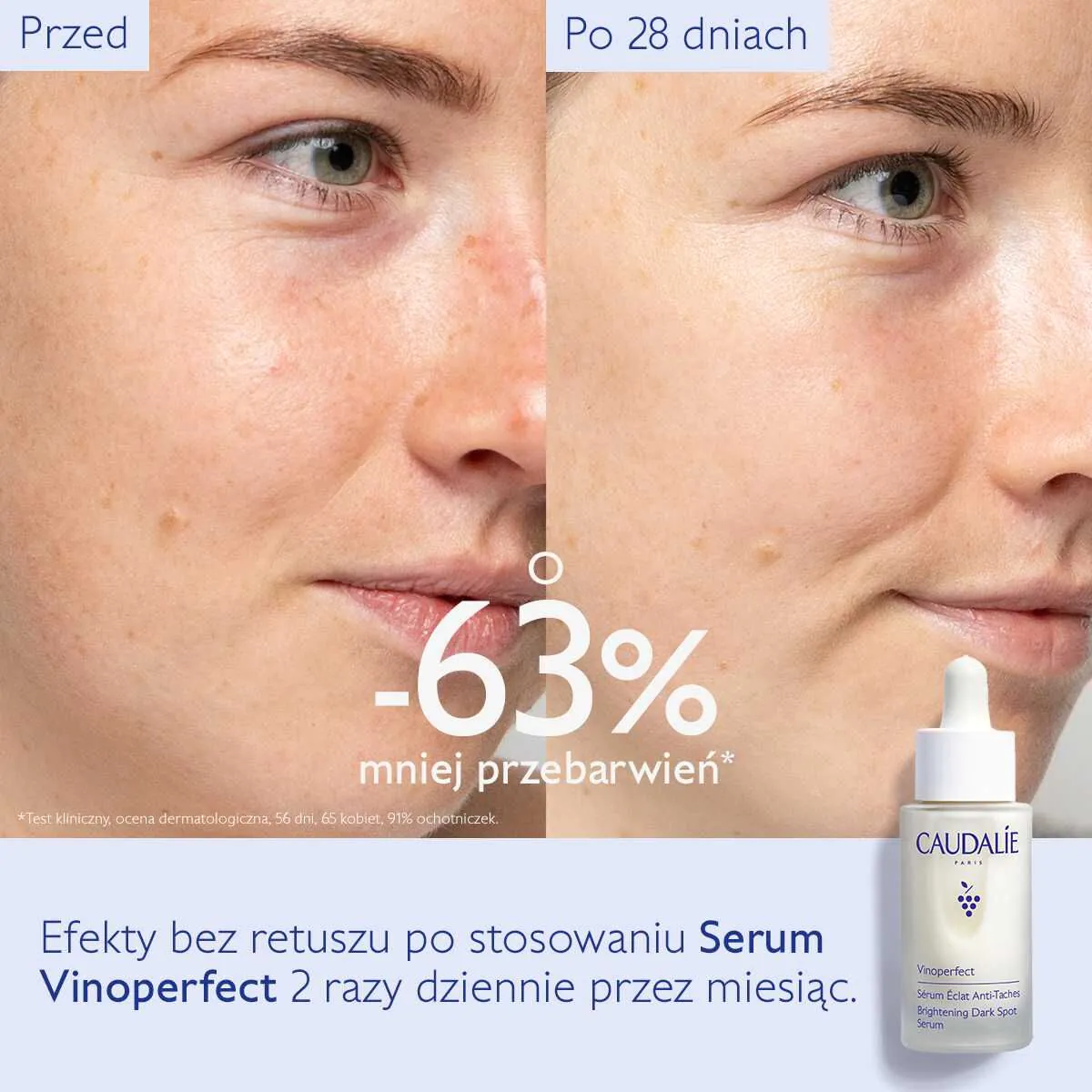 Caudalie Vinoperfect Serum rozjaśniające przebarwienia