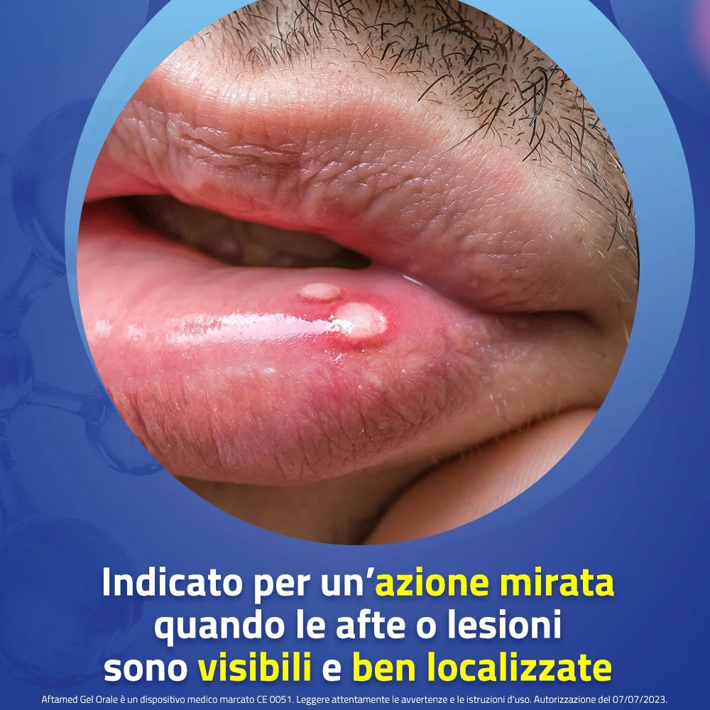AFTAMED Gel Aftamed 10 ml después de la aplicación