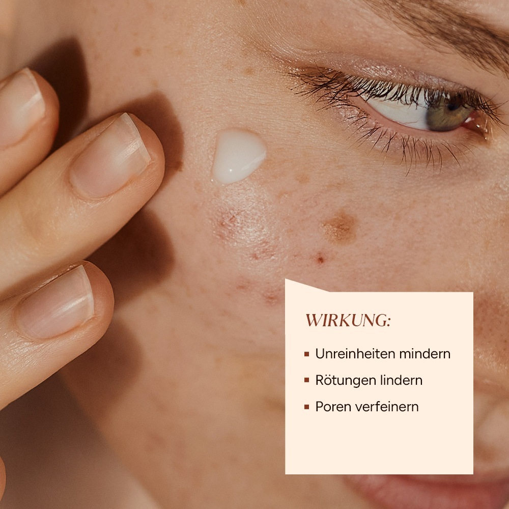 Junglück Glowserum azelaínové sérum - 50 ml