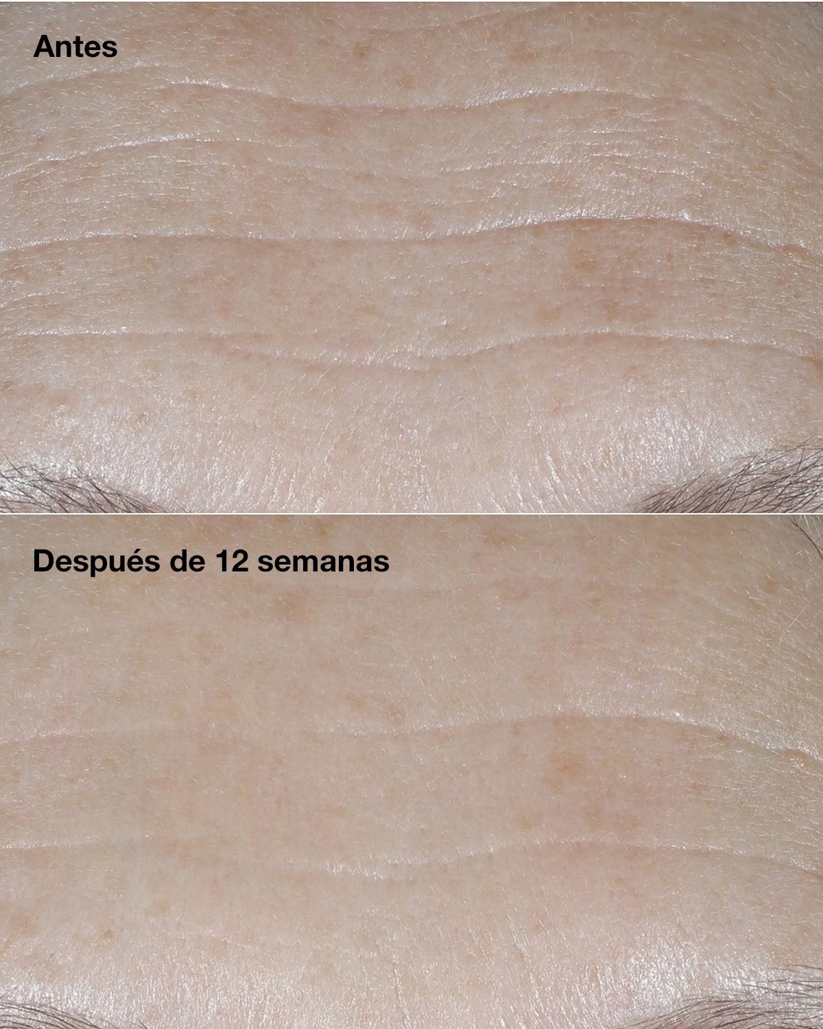 „Smart Clinical Repair“ SPF30 raukšles koreguojantis kremas Prabangus drėkinamasis ir maitinamasis kremas