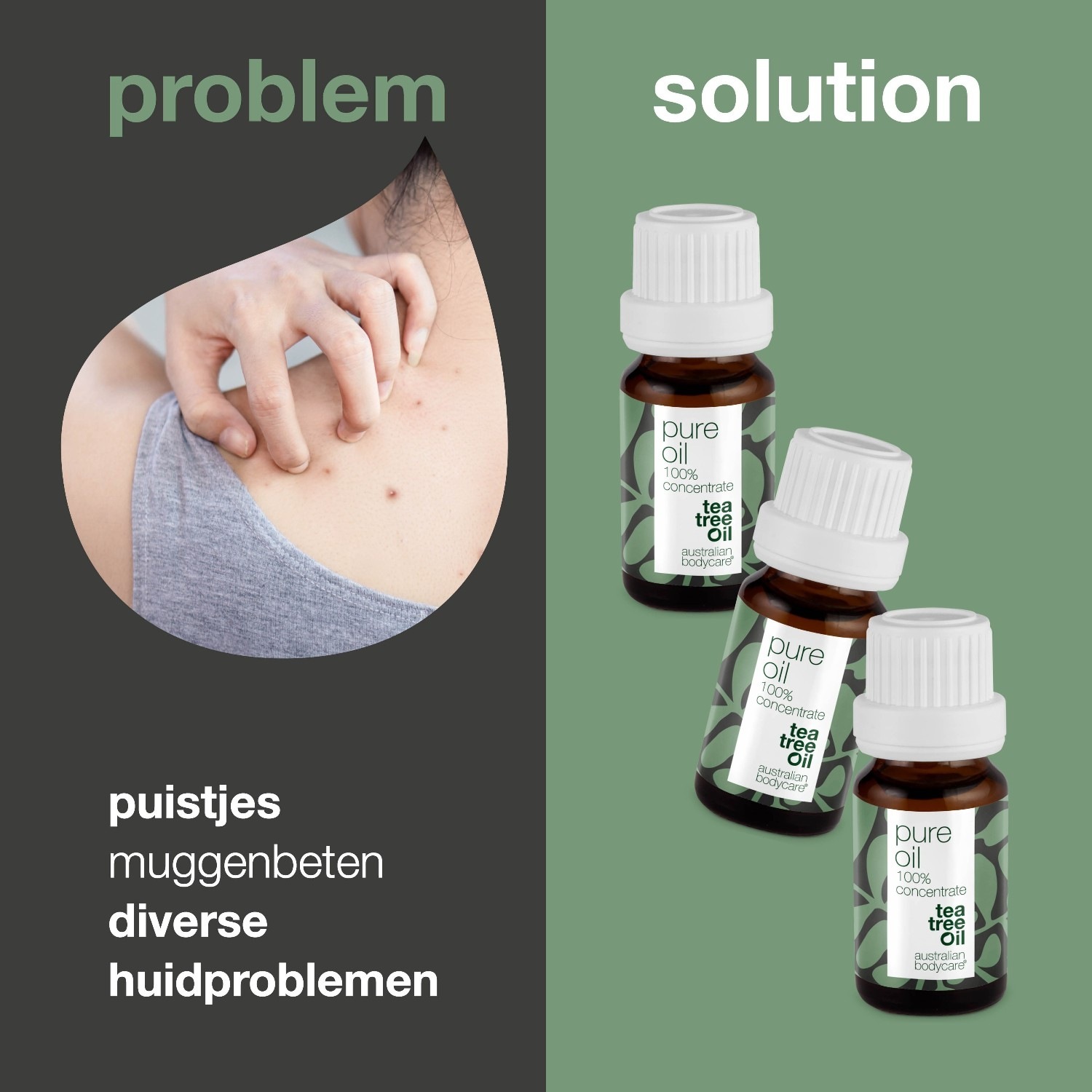Australian Bodycare ulje za tijelo s okusom čajevca 3x30ml - 1 komad