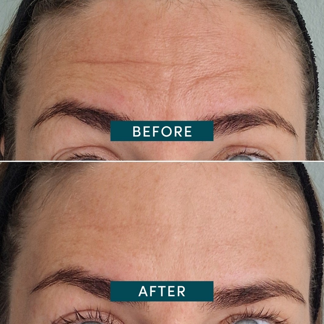 Abrikosų kaukė nuo senėjimo, kaktos pagalvėlės su vitaminu C – 30 vnt.