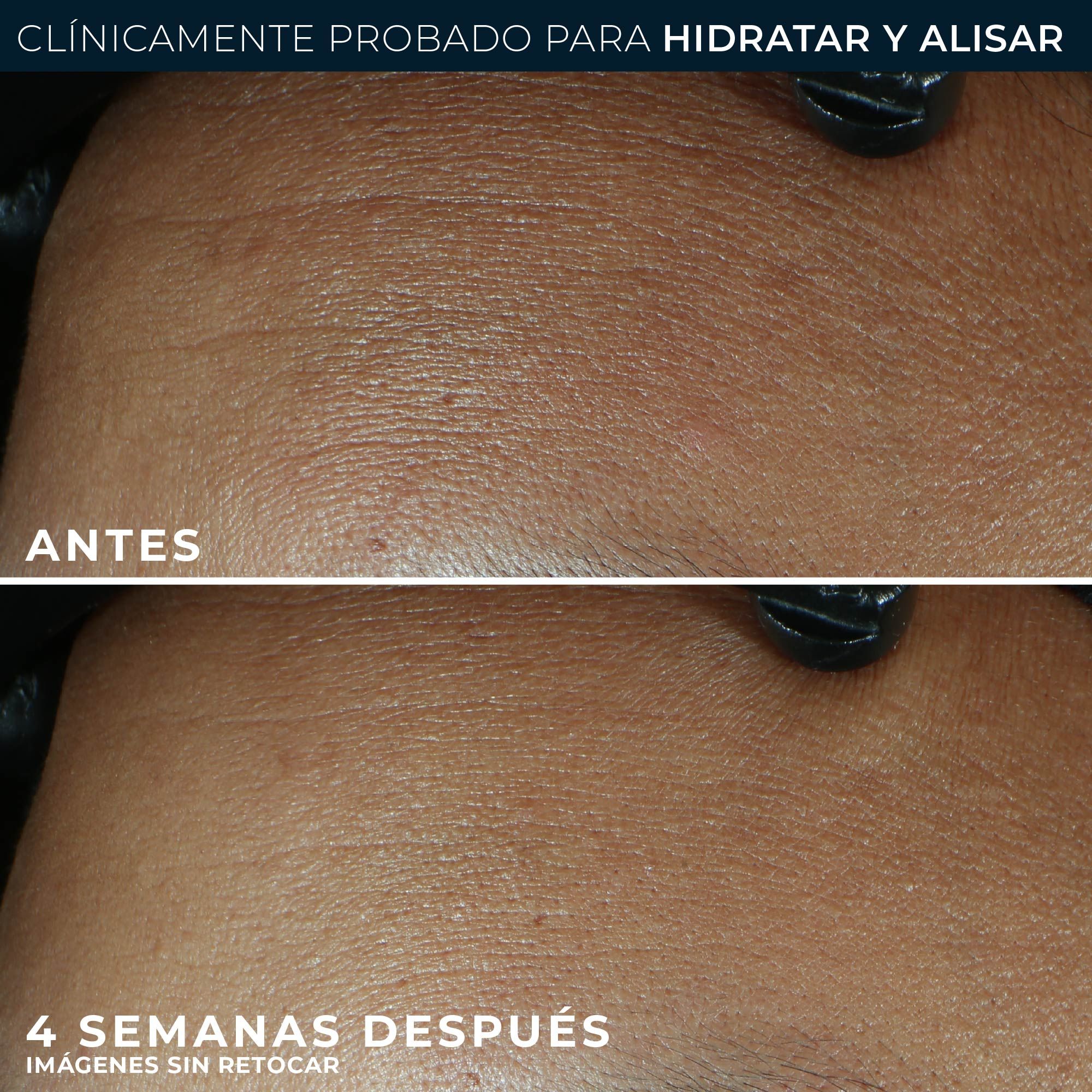 Retinol Correxion: Krema za zaglađivanje linija, maksimalna hidratacija Hidratantne kreme za lice iz parafarmacie