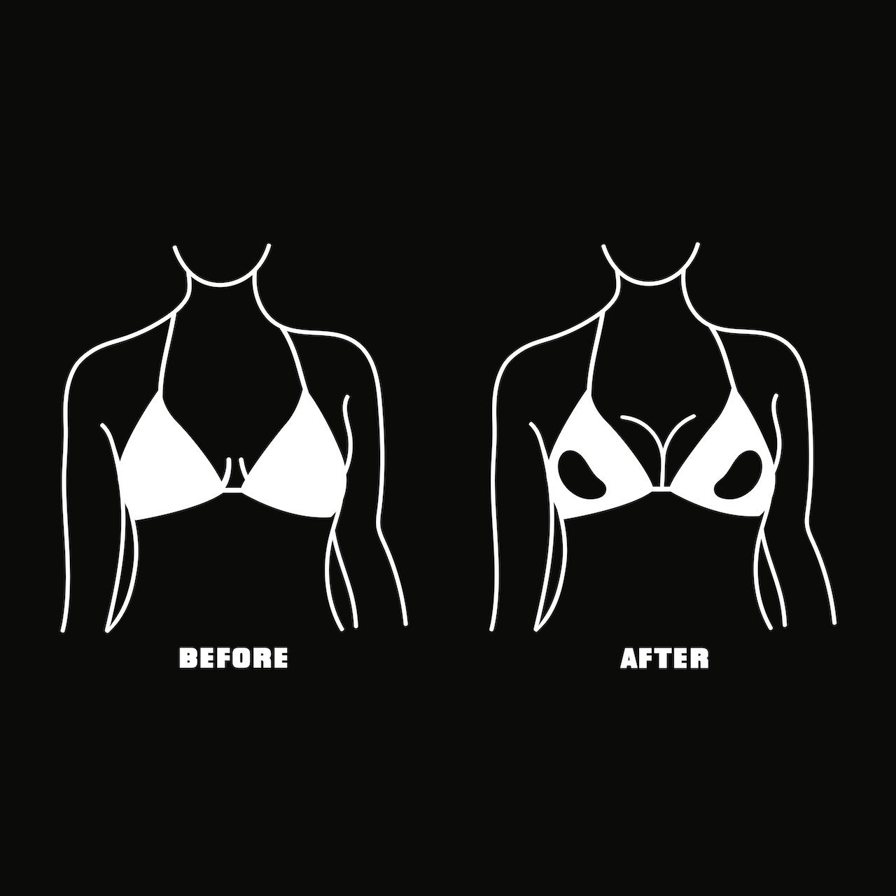 LITCHY Trokutasti ulošci za donje rublje - 1 komad