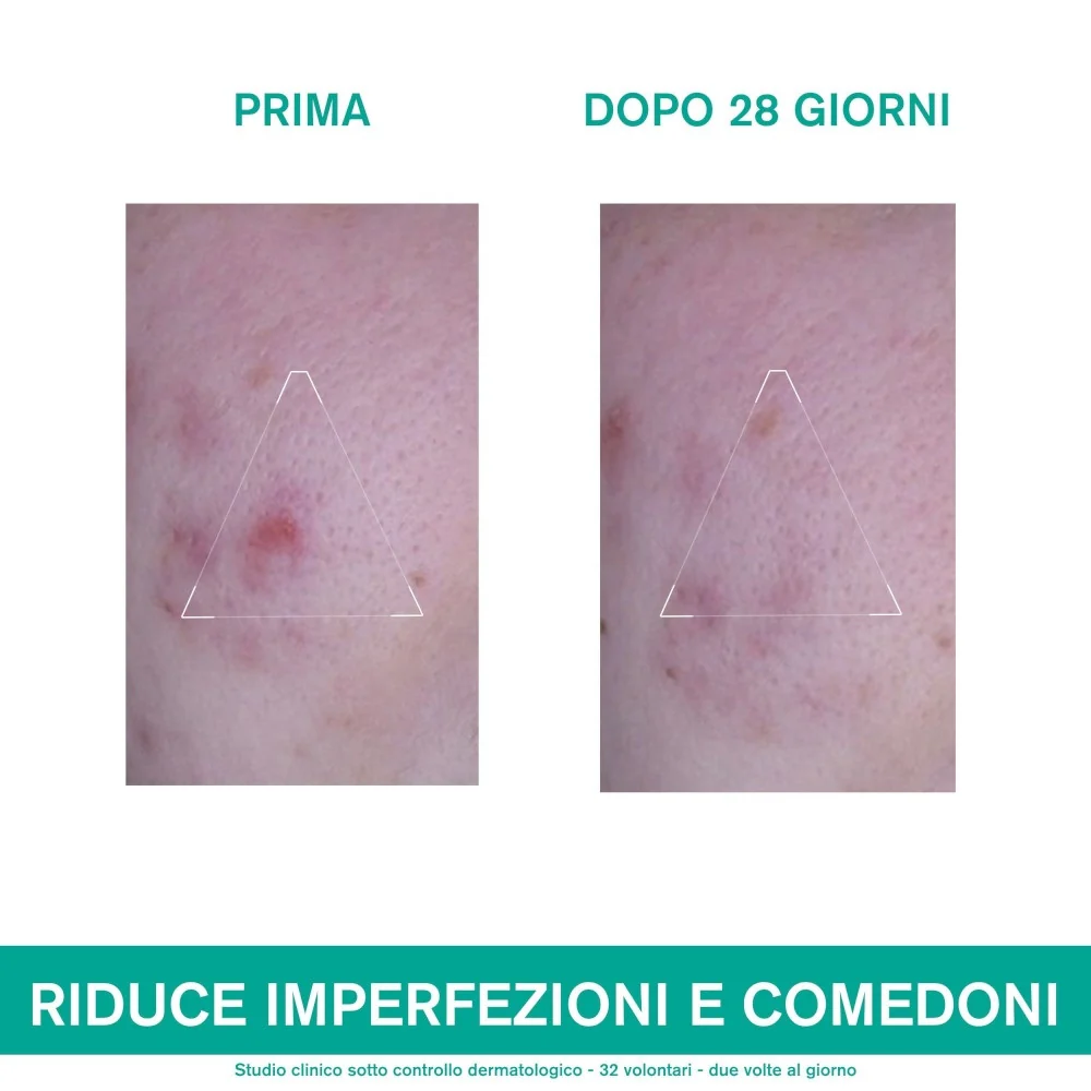 HYSÉAC 3  Regul+ Trattamento Globale Anti-Imperfezioni - Tratt.viso 24 ore antimperfezioni